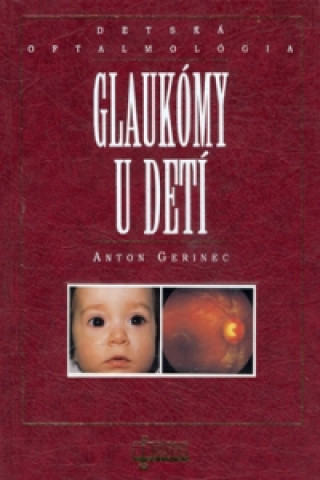 Knjiga Glaukómy u detí Anton Gerinec