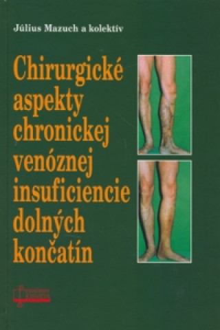 Könyv Chirurgické aspekty chronickej venóznej insuficiencie dolných končatín Július Mazúch a kol.