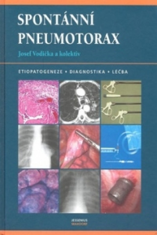 Kniha Spontánní pneumotorax Josef Vodička