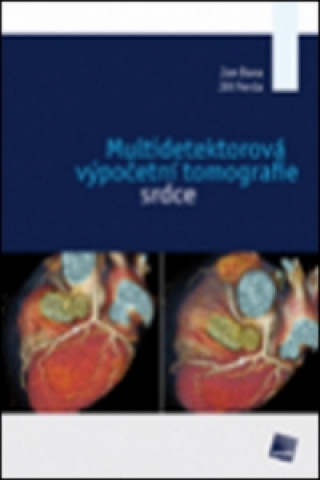 Kniha Multidetektorová výpočetní tomografie srdce Jan Baxa