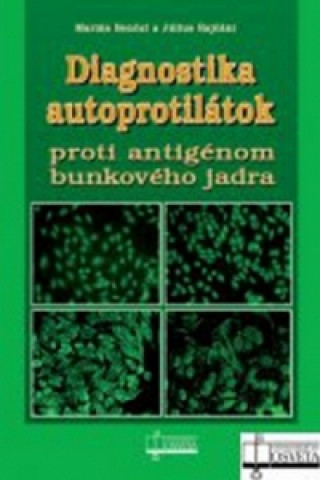 Książka Diagnostika autoprotilátok proti antigénom bunkového jadra Marián Benčat; Július Rajčáni