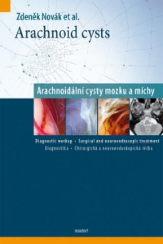 Книга Arachnoidální cysty mozku a míchy Zdeněk Novák