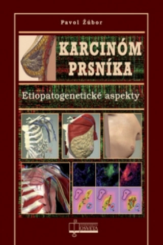 Könyv Karcinóm prsníka Pavol Žúbor