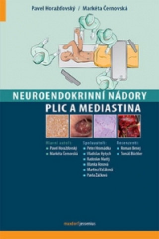 Könyv Neuroendokrinní nádory plic a mediastina Pavel Horažďovský