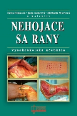 Kniha Nehojace sa rany Edita Hlinková