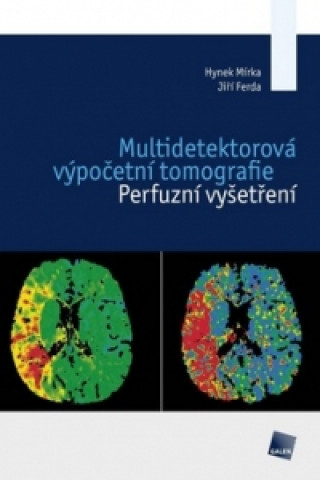 Knjiga Multidetektorová výpočetní tomografie Hynek Mírka; Jiří Ferda