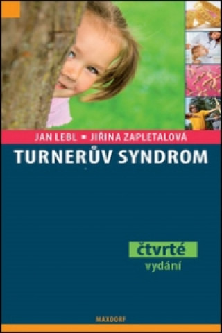 Книга Turnerův syndrom Jan Lebl; Jiřina Zapletalová