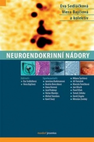 Kniha Neuroendokrinní nádory Eva Sedláčková