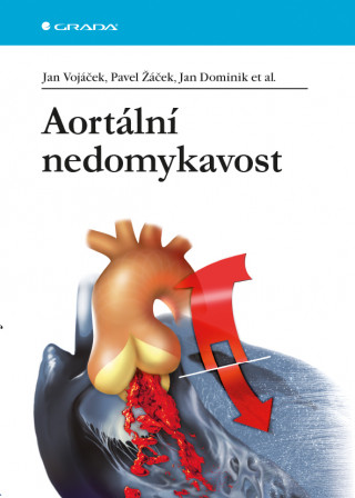 Book Aortální nedomykavost Jan Vojáček
