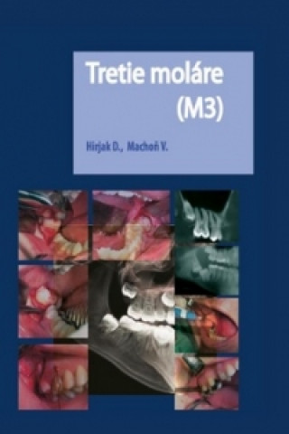 Kniha Tretie moláre (M3) Dušan Hirjak