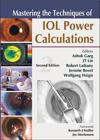 Knjiga Mastering the Techniques of IOL Power Calculations, Second Edition Ashok Garg