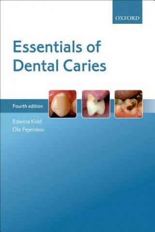 Kniha Essentials of Dental Caries Edwina A. M. Kidd
