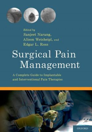 Könyv Surgical Pain Management 