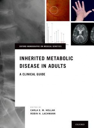 Könyv Inherited Metabolic Disease in Adults Carla E. M. Hollak