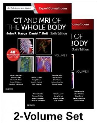 Kniha CT and MRI of the Whole Body, 2-Volume Set John R. Haaga