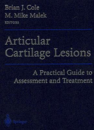 Kniha Articular Cartilage Lesions 