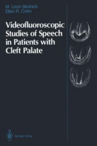 Kniha Videofluoroscopic Studies of Speech in Patients with Cleft Palate M. Leon Skolnick