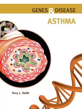 Carte Asthma Terry L. Smith