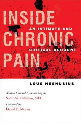 Carte Inside Chronic Pain Lous Heshusius