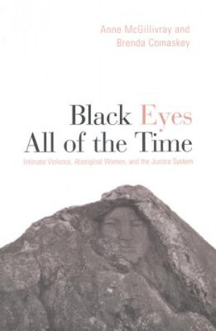 Könyv Black Eyes All of the Time Anne McGillivry