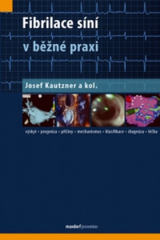 Kniha Fibrilace síní v běžné praxi Josef Kautzner