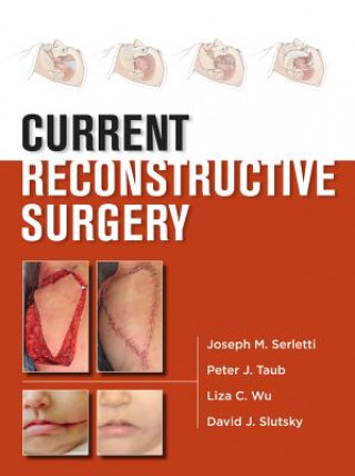 Knjiga Current Reconstructive Surgery Joseph Serletti