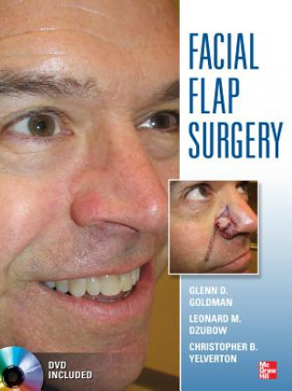 Βιβλίο Facial Flaps Surgery Glenn Goldman