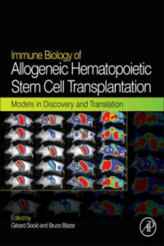 Kniha Immune Biology of Allogeneic Hematopoietic Stem Cell Transplantation Gerard Socie