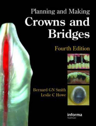 Carte Planning and Making Crowns and Bridges Smith
