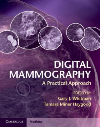 Könyv Digital Mammography Gary J Whitman