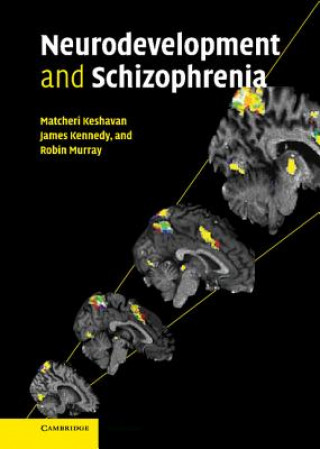 Knjiga Neurodevelopment and Schizophrenia Matcheri S. Keshavan