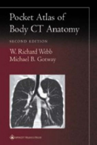 Kniha Pocket Atlas of Body CT Anatomy Michael B. Gotway