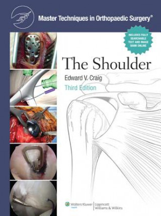 Kniha Master Techniques in Orthopaedic Surgery: Shoulder Edward Craig