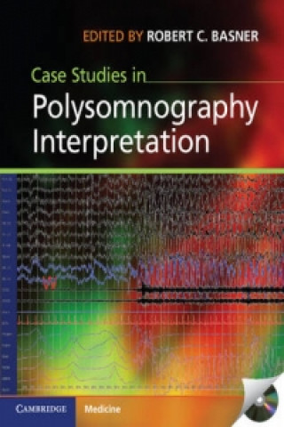 Kniha Case Studies in Polysomnography Interpretation Robert C Basner