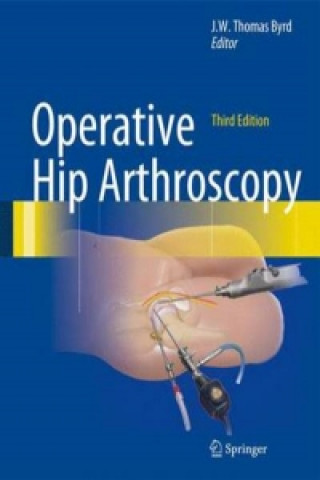 Könyv Operative Hip Arthroscopy J. W. Thomas Byrd