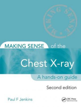 Книга Making Sense of the Chest X-ray Paul F Jenkins
