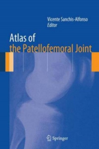 Książka Atlas of the Patellofemoral Joint Vicente Sanchis Alfonso