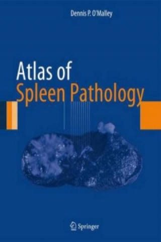 Kniha Atlas of Spleen Pathology Dennis O Malley