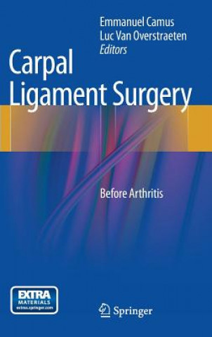 Carte Carpal Ligament Surgery Luc Camus