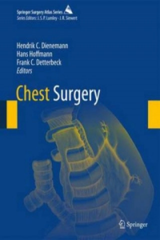 Kniha Chest Surgery Hendrik C Dienemann