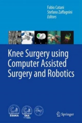 Carte Knee Surgery using Computer Assisted Surgery and Robotics Fabio Catani