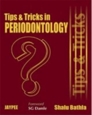 Kniha Tips and Tricks in Periodontology Shalu Bathla