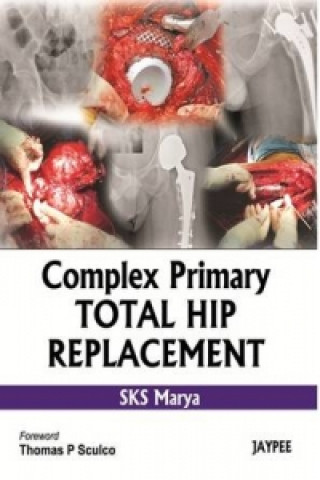 Kniha Complex Primary Total Hip Replacement SKS Myarya