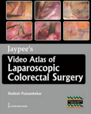 Kniha Jaypee's Video Atlas of  Laparoscopic Colorectal Surgery Shailesh Puntambekar