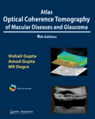 Carte Atlas Optical Coherence Tomography of Macular Diseases and Glaucoma Vishali Gupta