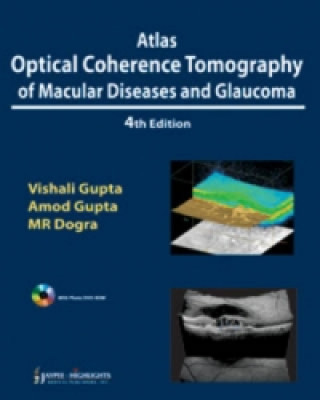 Knjiga Atlas Optical Coherence Tomography of Macular Diseases and Glaucoma Vishali Gupta