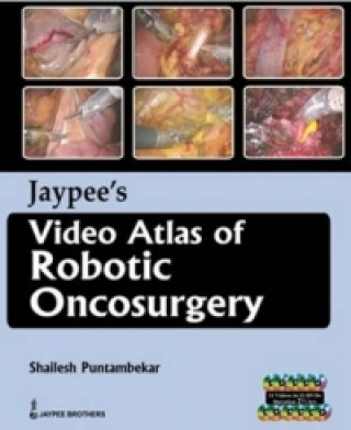 Libro Jaypee's Video Atlas of Robotic Oncosurgery Shailesh Puntambekar