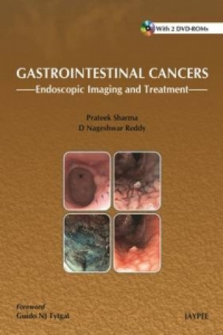 Kniha Gastrointestinal Cancers: Prateek Sharma