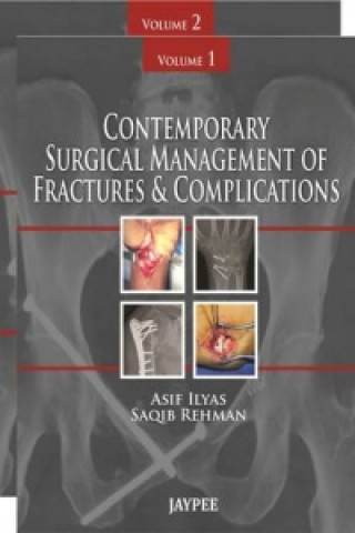 Carte Contemporary Surgical Management of Fractures and Complications Asif Llyas