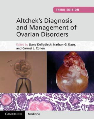 Könyv Altchek's Diagnosis and Management of Ovarian Disorders Liane Deligdisch